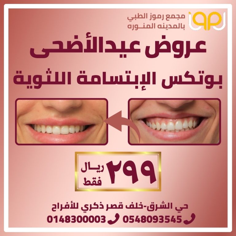 بوتكس الابتسامة اللثوية