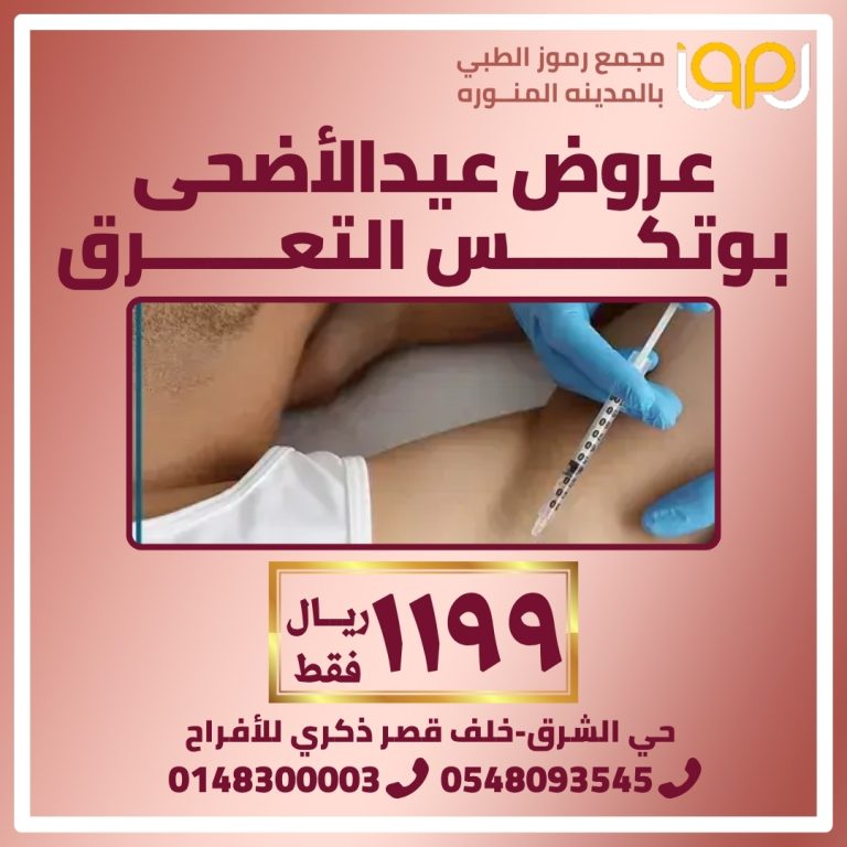 بوتكس التعرق