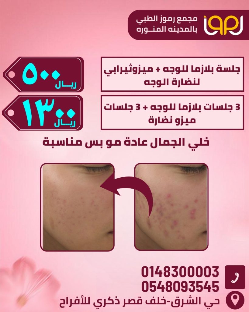 جلسة بلازما للوجه