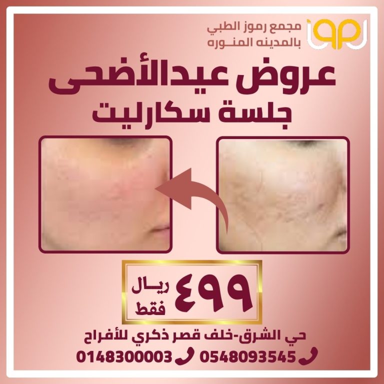 جلسة سكارليت