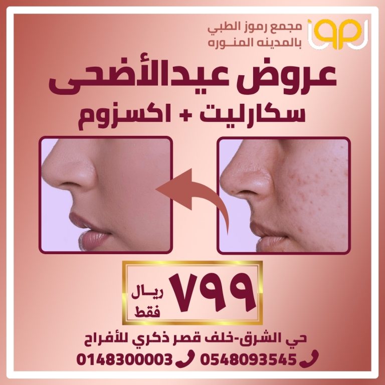 سكاربيت مع اكسزوم